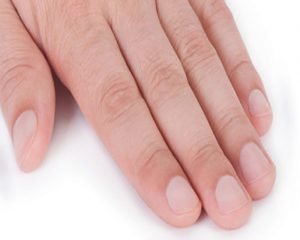 Read more about the article Must read if you have crescent moon marks on your nails!