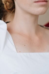 Read more about the article Simple home remedies to get rid of grime on elbows and neck